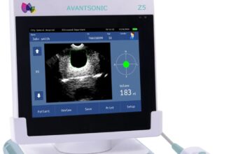What Is a Bladder Scanner? Uses, Benefits